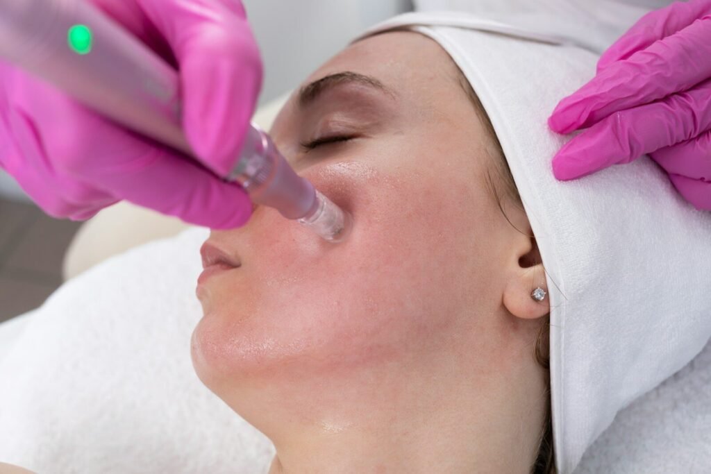vibrating blackhead remover
